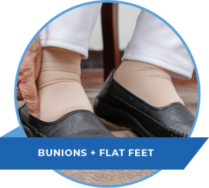 bunions-flat-feet-nj